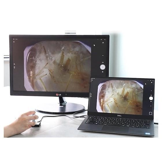 Anyty 3R-MJL03 กล้องไมโครสโคปแบบพกพาทรงกรวยพร้อมไฟ LED-photo2